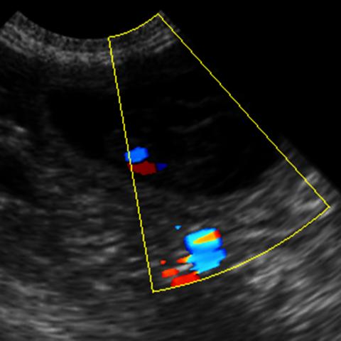 Ultraschallbild zeigt bereits Herzschläge der zukünftigen Welpen in rot/blau